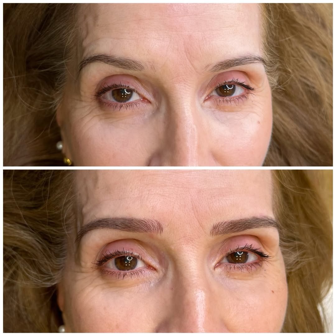 Antes e depois de micropigmentação de sobrancelhas