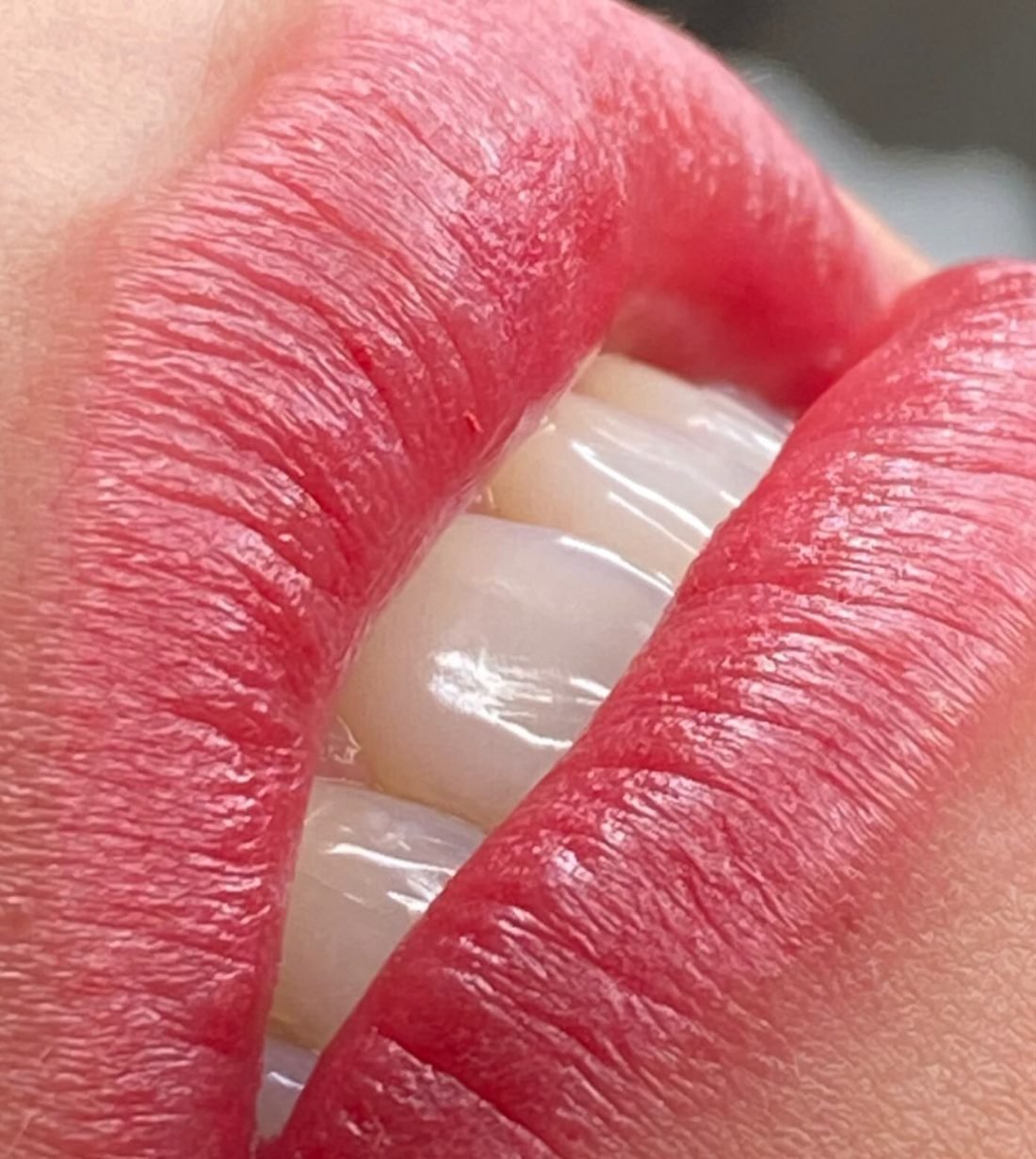 Resultado de micropigmentação labial